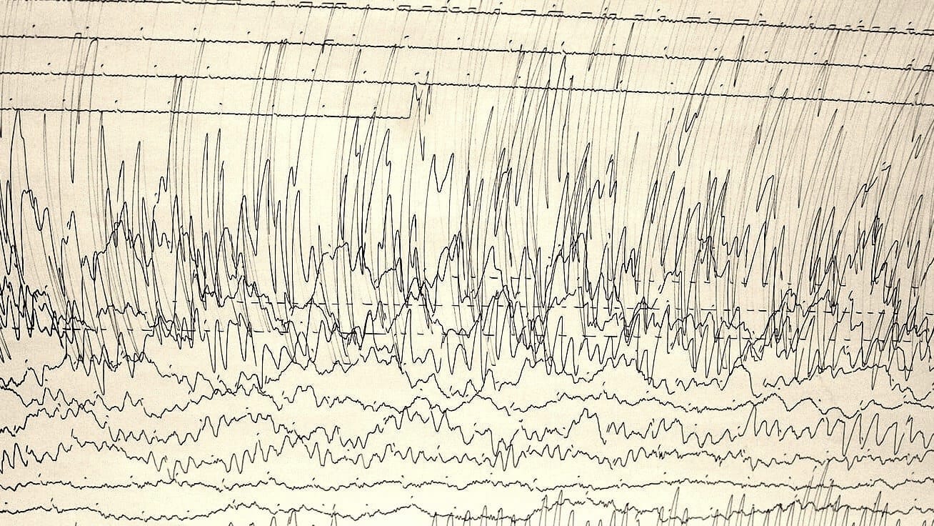 The Loeb Scale for science PR disasters